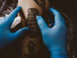fjerne tatovering