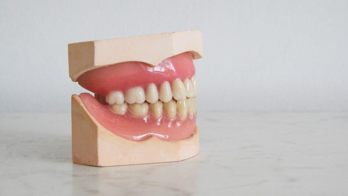 Hvide tænder: Er det sundt at afblege sine tænder?