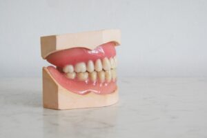 hvide tænder tandlæge